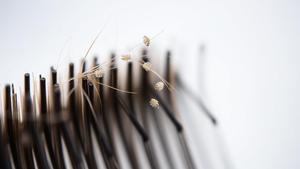 A close-up image of a hairbrush with a few strands of hair and tiny, translucent lice nits, set against a soft-focus background.
