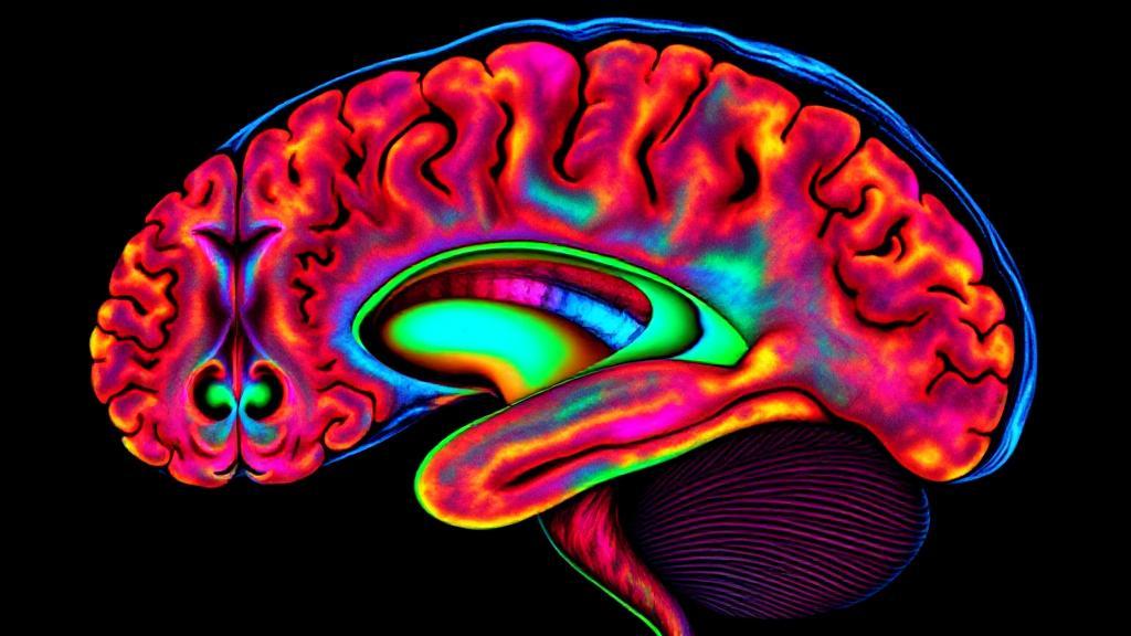 A detailed cross-sectional image of a human brain MRI scan, highlighting various regions and structures in vibrant colors.